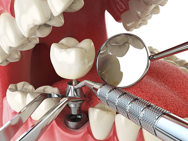 Best Emergency Treatment for Oral Infections in Ford Heights, IL