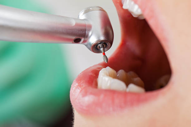 Best Emergency Care for Gum Disease in Ford Heights, IL